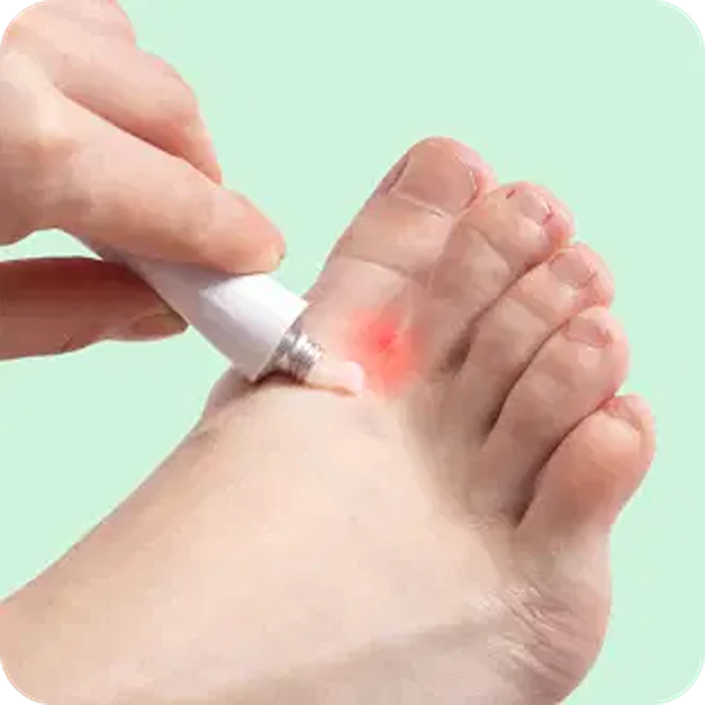 Anti Fungal