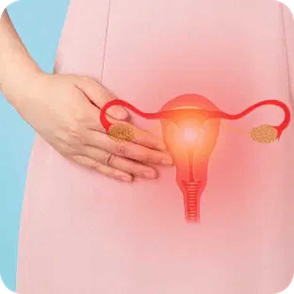 PCOS & Progestational Harmones