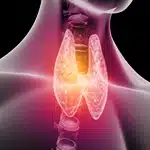 Anti Thyroid Management